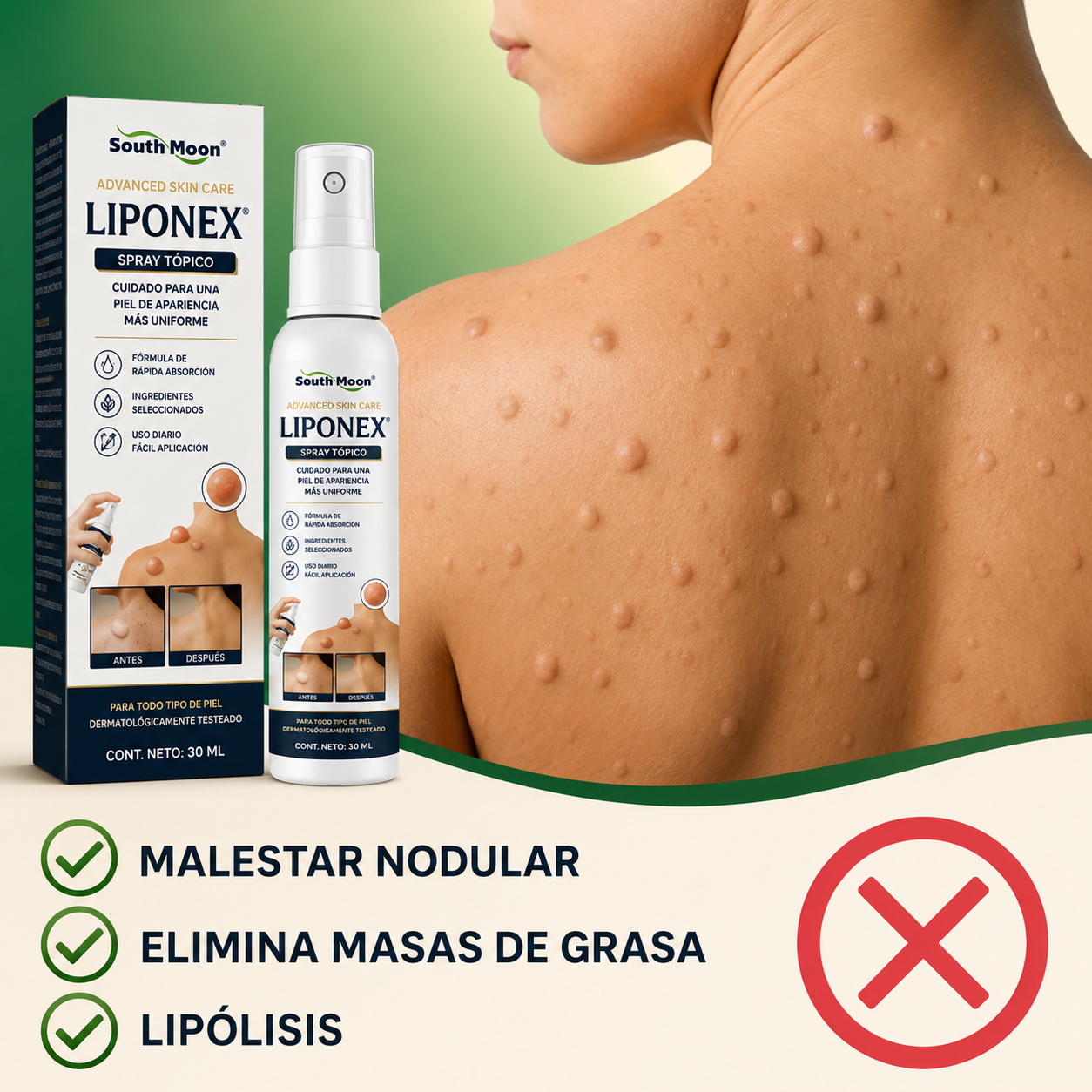 LIPONEX PLUS® - ¡Spray Tópico Para Reducir Bultos Adiposos!