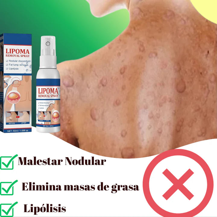 LIPOMAX® – ¡Spray Efectivo Para Reducir Bultos Adiposos!