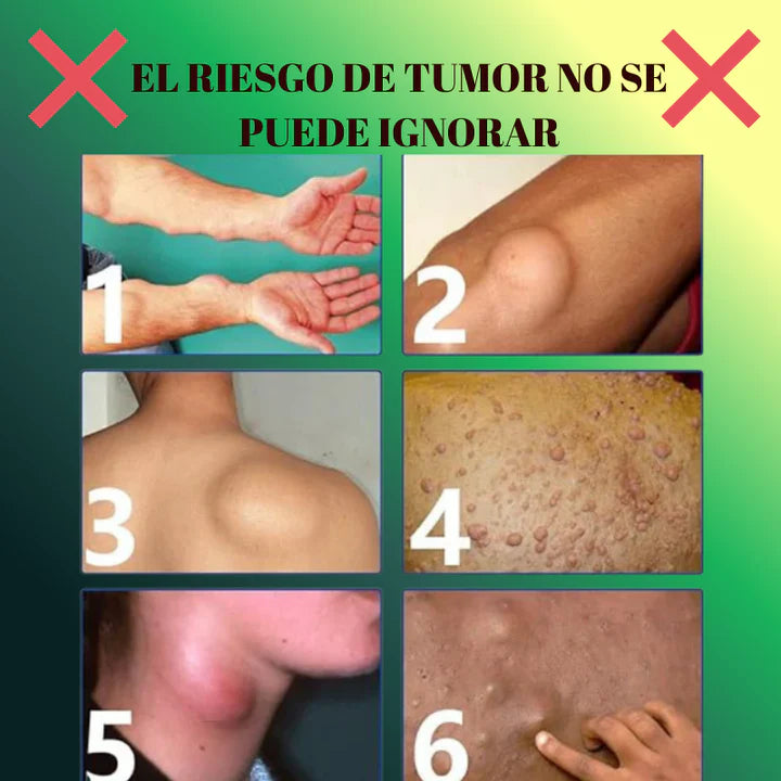 LIPOMAX® – ¡Spray Efectivo Para Reducir Bultos Adiposos!