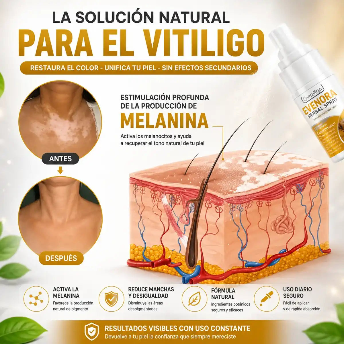 EVENORA® - ¡Spray Efectivo Para Eliminar Manchas Del Cuerpo!