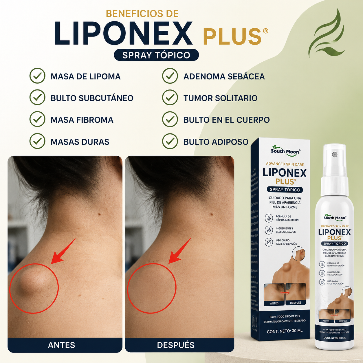 LIPONEX PLUS® - ¡Spray Tópico Para Reducir Bultos Adiposos!