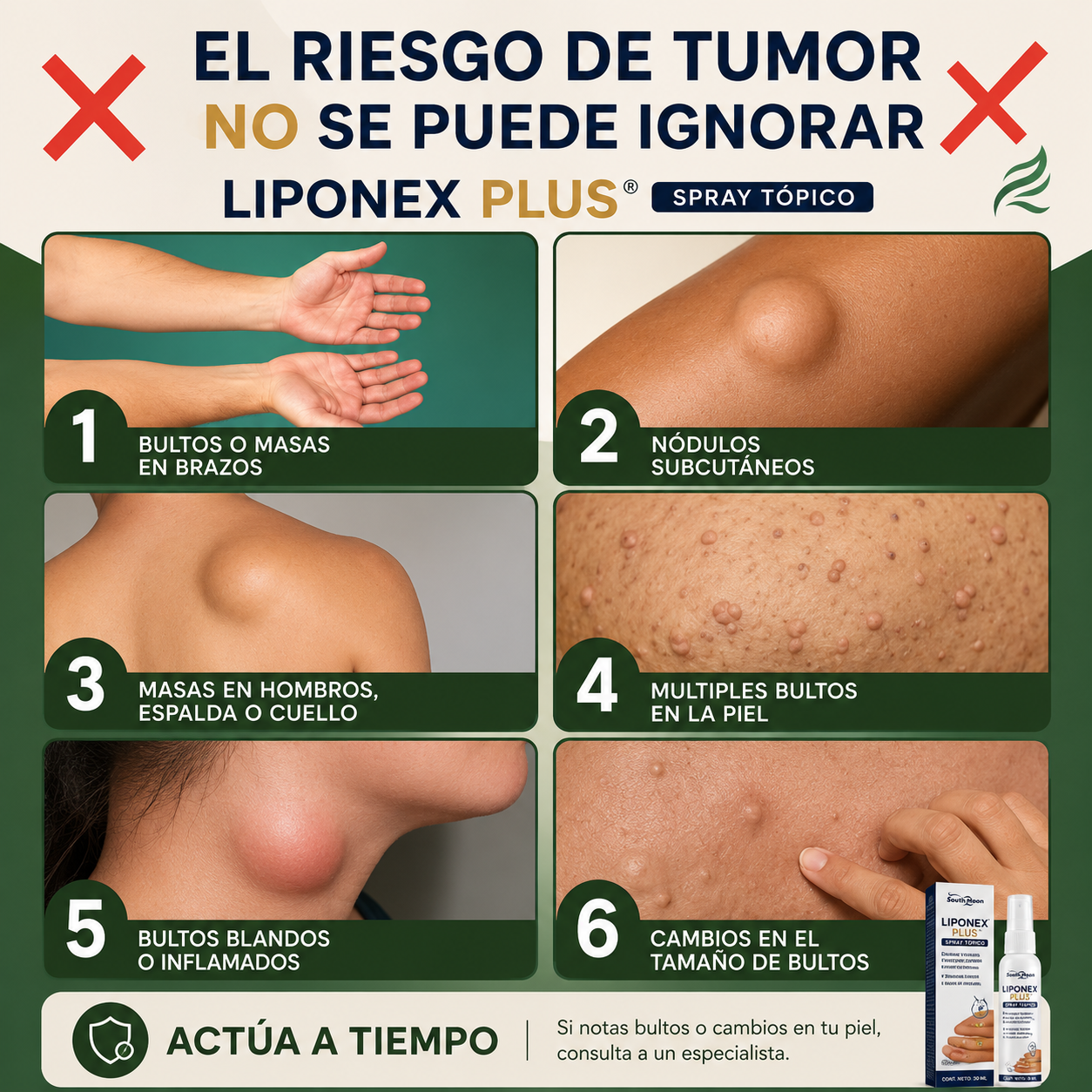 LIPONEX PLUS® - ¡Spray Tópico Para Reducir Bultos Adiposos!